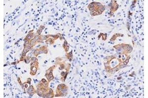 Immunohistochemistry (IHC) image for anti-Fas (TNFRSF6)-Associated Via Death Domain (FADD) (AA 1-208), (N-Term) antibody (ABIN317514) (FADD Antikörper  (N-Term))