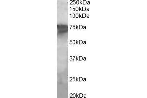 ABIN185483 (2µg/ml) staining of Human Liver lysate (35µg protein in RIPA buffer). (PEPCK Antikörper  (Internal Region))