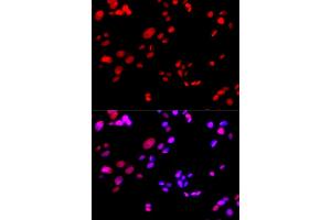 Immunofluorescence analysis of GFP-RNF168 transgenic U2OS cells using RPA2 antibody (ABIN5971215). (RPA2 Antikörper)