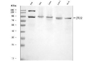 Western blot analysis of ZW10 using anti-ZW10 antibody (ABIN7601437).