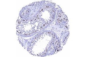 Testis Strong SOX9 staining of Sertoli cells (Rekombinanter SOX9 Antikörper  (AA 393-508))