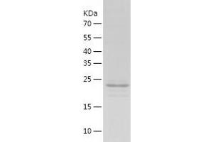 Western Blotting (WB) image for Nudix (Nucleoside Diphosphate Linked Moiety X)-Type Motif 21 (NUDT21) (AA 1-227) protein (His tag) (ABIN7124243) (NUDT21 Protein (AA 1-227) (His tag))