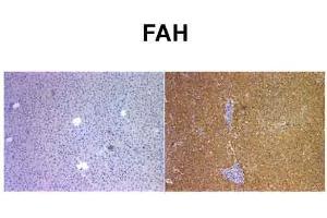 Sample Type: Human Liver and Mouse FAH KO liverPrimary Dilution: 1:400 (FAH Antikörper  (C-Term))