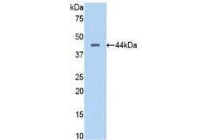 Western blot analysis of recombinant Human PTa. (PTF1A Antikörper  (AA 177-328))
