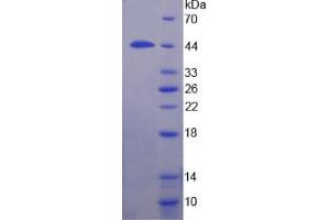 SDS-PAGE analysis of Human TBP Protein. (TBP Protein)