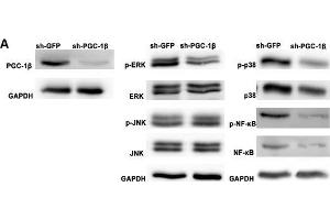 Peroxisome proliferator-activated receptor-gamma coactivator-1 β (PGC-1β) knockdown attenuates proinflammatory cytokines, matrix metalloproteinases (MMPs) and receptor activator of nuclear factor-kappa B ligand (RANKL) production in rheumatoid arthritis (RA)-fibrolast-like synoviocytes (FLS). (PPARGC1B Antikörper  (AA 901-1023))