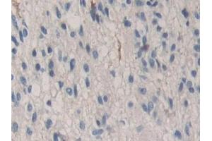Immunohistochemistry (IHC) image for anti-Cadherin-16 (CDH16) (AA 37-287) antibody (ABIN7434509)