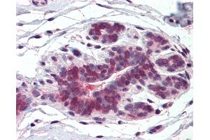 Anti-ELOVL5 antibody IHC of human breast. (ELOVL5 Antikörper  (Internal Region))
