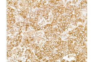 anti-Ribosomal Protein L7 (RPL7) (C-Term) antibody