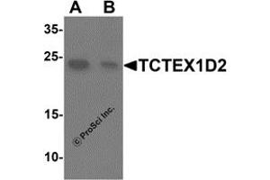 Western Blotting (WB) image for anti-Tctex1 Domain Containing 2 (TCTEX1D2) (N-Term) antibody (ABIN1587948)