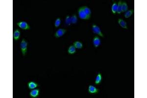 Immunofluorescent analysis of PC-3 cells using ABIN7173083 at dilution of 1:100 and Alexa Fluor 488-congugated AffiniPure Goat Anti-Rabbit IgG(H+L) (TMEM161A Antikörper  (AA 29-98))