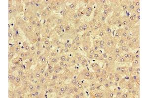 Immunohistochemistry of paraffin-embedded human liver tissue using ABIN7158760 at dilution of 1:100 (LPCAT3 Antikörper  (AA 306-363))