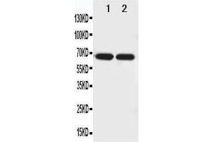 Anti-Netrin 1 antibody, Western blotting Lane 1: U87 Cell Lysate Lane 2: COLO320 Cell Lysate (Netrin 1 Antikörper  (N-Term))