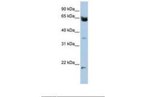 Image no. 1 for anti-Homeobox and Leucine Zipper Encoding (HOMEZ) (AA 72-121) antibody (ABIN6738394) (HOMEZ Antikörper  (AA 72-121))