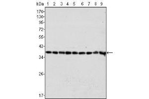 Western Blot showing GAPDH antibody used against Hela (1), A549 (2), A431 (3), MCF-7 (4), K562 (5), Jurkat (6), HL60 (7), SKN-SH (8) and SKBR-3 (9) cell lysate. (GAPDH Antikörper)