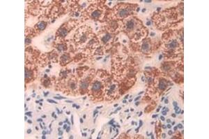Immunohistochemistry (IHC) image for anti-3-hydroxybutyrate Dehydrogenase, Type 1 (BDH1) (AA 1-343) antibody (ABIN7436258)