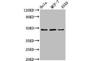 Western Blot Positive WB detected in: Hela whole cell lysate, MCF-7 whole cell lysate, A549 whole cell lysate All lanes: LCOR antibody at 4. (Lcor Antikörper  (AA 13-144))