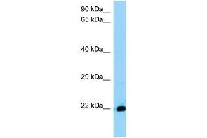 WB Suggested Anti-4930572J05Rik Antibody Titration: 1. (THEM6 Antikörper  (C-Term))