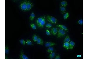 Immunofluorescence staining of Hela cells with ABIN7146911 at 1:50, counter-stained with DAPI. (CARD16 Antikörper  (AA 1-197))