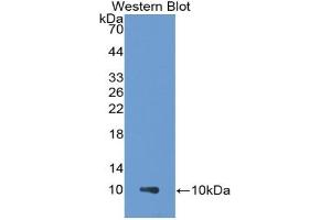 Detection of Recombinant PARC, Human using Monoclonal Antibody to Pulmonary Activation Regulated Chemokine (PARC) (CCL18 Antikörper  (AA 21-89))