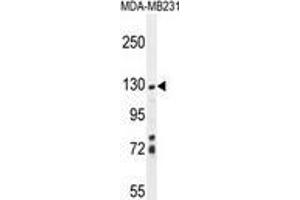 ZSWIM6 Antibody (C-term) western blot analysis in MDA-MB231 cell line lysates (35 µg/lane). (ZSWIM6 Antikörper  (C-Term))
