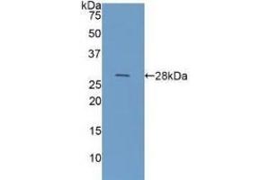 Detection of Recombinant GAL3, Human using Polyclonal Antibody to Galectin 3 (GAL3) (Galectin 3 Antikörper  (AA 1-250))
