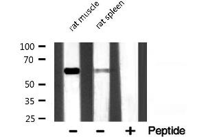 Western blot analysis of P62/SQSTM1 expression in various lysates