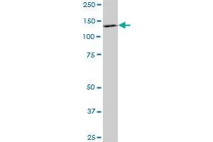 PDGFRB monoclonal antibody (M08), clone 4C12. (PDGFRB Antikörper  (AA 33-133))