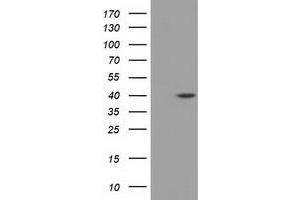 Western Blotting (WB) image for anti-Deoxyhypusine Synthase (DHPS) antibody (ABIN1497824)