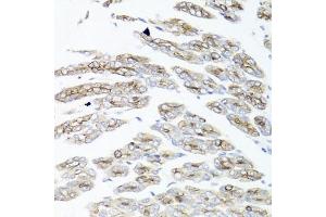 Immunohistochemistry of paraffin-embedded mouse stomach using IER3 antibody (ABIN6134174, ABIN6142158, ABIN6142159 and ABIN6224665) at dilution of 1:100 (40x lens). (IER3 Antikörper  (C-Term))