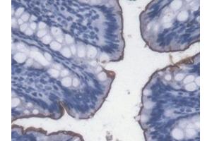 Detection of LPS in Rat Colon Tissue using Monoclonal Antibody to Lipopolysaccharide (LPS) (Lipopolysaccharides (LPS) Antikörper)