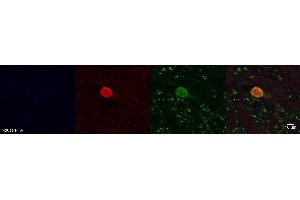 Immunohistochemistry (IHC) image for anti-Aldehyde Dehydrogenase 1 Family, Member A1 (ALDH1A1) antibody (ABIN7456135)