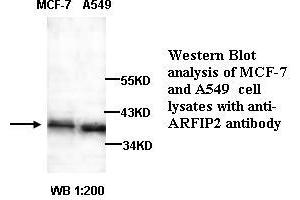 Image no. 1 for anti-ADP-Ribosylation Factor Interacting Protein 2 (ARFIP2) antibody (ABIN790882)