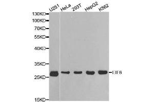 Western blot analysis of extracts of various cell lines, using EIF6 antibody. (EIF6 Antikörper  (AA 1-245))