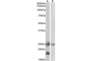 AP22426PU-N DCTN3 antibody staining of Mouse (A) and Rat (B) Skeletal Muscle lysates at 0. (DCTN3 Antikörper  (Internal Region))