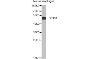 Western blot analysis of extracts of mouse esophagus, using COX10 Antibody (ABIN2561967) at 1:1000 dilution. (COX10 Antikörper)