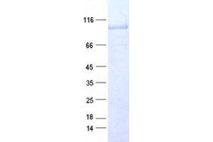 Validation with Western Blot (CTNNB1 Protein (DYKDDDDK Tag))