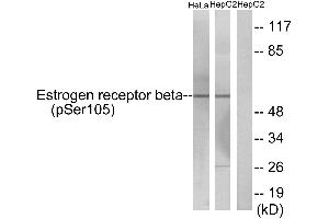 Western blot analysis of extracts from HeLa cells and HepG2 cells, using Estrogen Receptor-β (Phospho-Ser105) antibody.