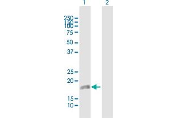 DUSP22 Antikörper  (AA 1-184)