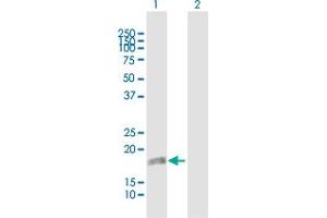 Western Blot analysis of DUSP22 expression in transfected 293T cell line by DUSP22 MaxPab polyclonal antibody. (DUSP22 Antikörper  (AA 1-184))