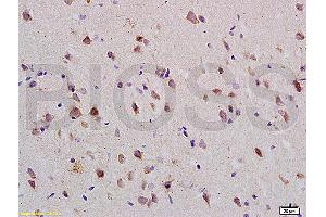Formalin-fixed and paraffin embedded: rat brain tissue labeled with Anti-Nogo-R Polyclonal Antibody (ABIN725420), Unconjugated at 1:200 followed by conjugation to the secondary antibody and DAB staining