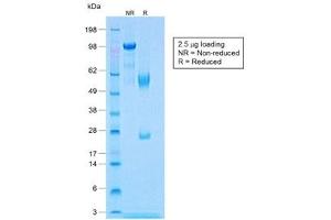 SDS-PAGE analysis of purified, BSA-free recombinant Calponin antibody (clone CNN1/1408R) as confirmation of integrity and purity. (Rekombinanter Calponin Antikörper)