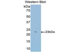 Western Blotting (WB) image for anti-Fibulin 1 (FBLN1) (AA 399-578) antibody (ABIN1175705) (Fibulin 1 Antikörper  (AA 399-578))