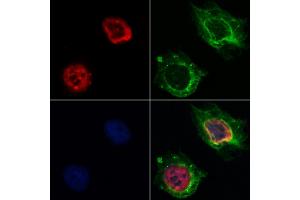 ABIN6262321 and ABIN6268789 staining Hela by IF/ICC. (HNRNPH1 Antikörper  (Internal Region))