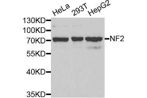 Western blot analysis of extracts of various cell lines, using NF2 antibody. (Merlin Antikörper)