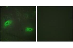 Immunofluorescence analysis of HeLa cells, using TNFSF9 Antibody. (TNFSF9 Antikörper  (AA 31-80))