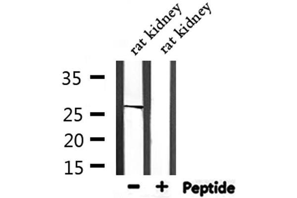 TWEAK antibody  (N-Term)