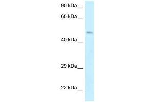 Western Blot showing EPB49 antibody used at a concentration of 1 ug/ml against Jurkat Cell Lysate