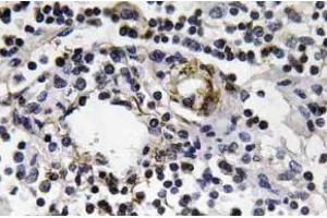 Immunohistochemistry (IHC) analyzes of IFN-gamma antibody in paraffin-embedded human lymph node tissue. (Interferon gamma Antikörper)