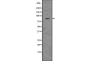 Western Blotting (WB) image for anti-Nephrosis 1, Congenital, Finnish Type (Nephrin) (NPHS1) antibody (ABIN6263596)